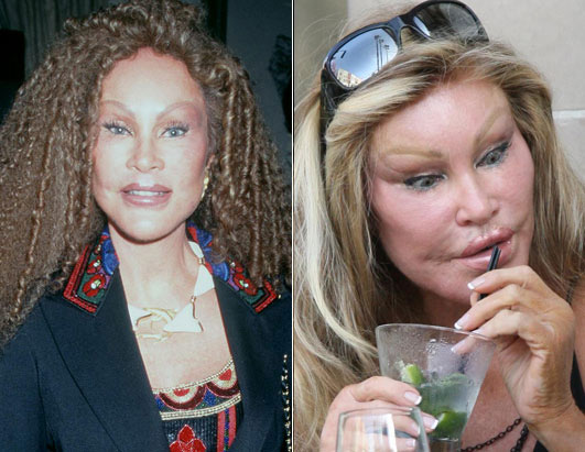 abc_wildenstein_080917_ssh.jpg