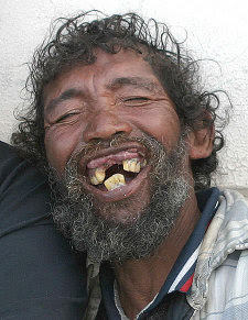 Why do British people have bad teeth? | AnandTech Forums: Technology,  Hardware, Software, and Deals