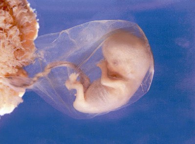 12_Week_Fetus.jpeg