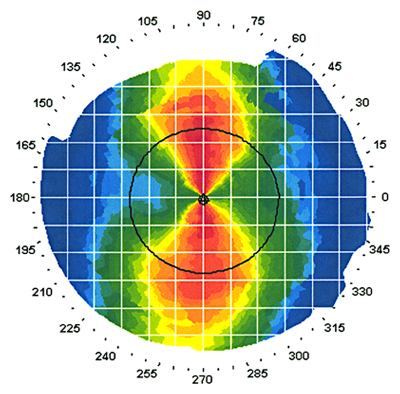 zeiss_atlas_topographer.png