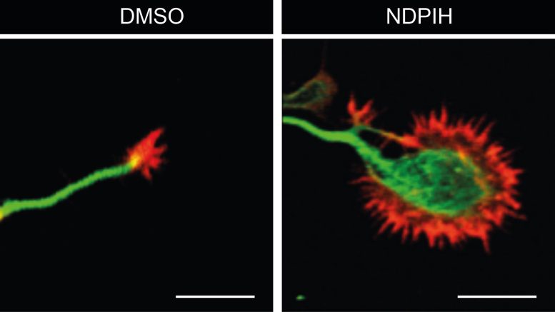 Control-and-Treated-Neuron-Growth-Cones-Comparison-777x437.jpg