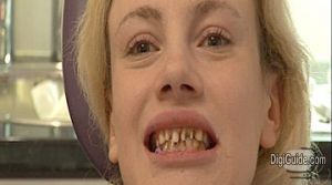 1175716800000-596488-BritainsWorstTeeth.jpg