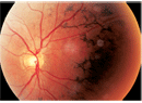 www.reviewofoptometry.com